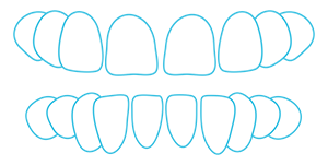Teeth Spacing and gaps
